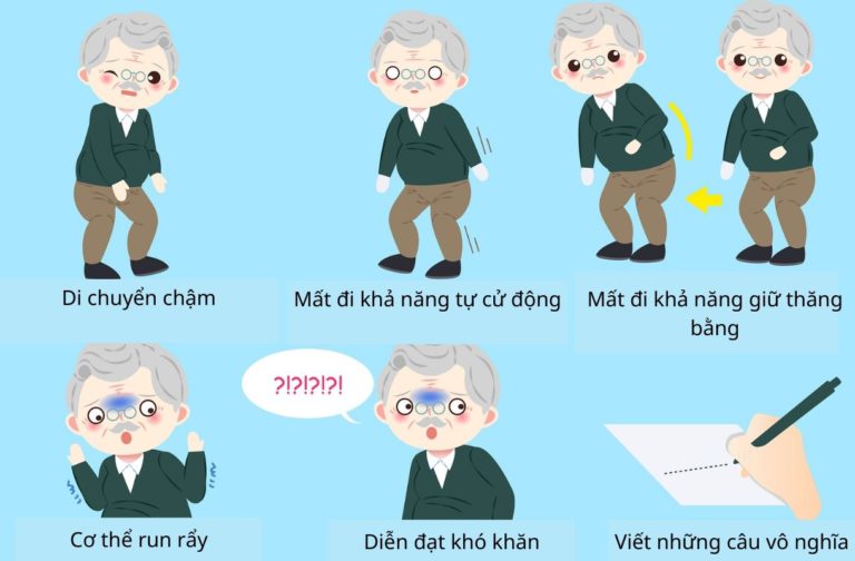 Nguyên nhân gây ra các bệnh hệ thần kinh như parkinson, run vô căn, alzheimer…