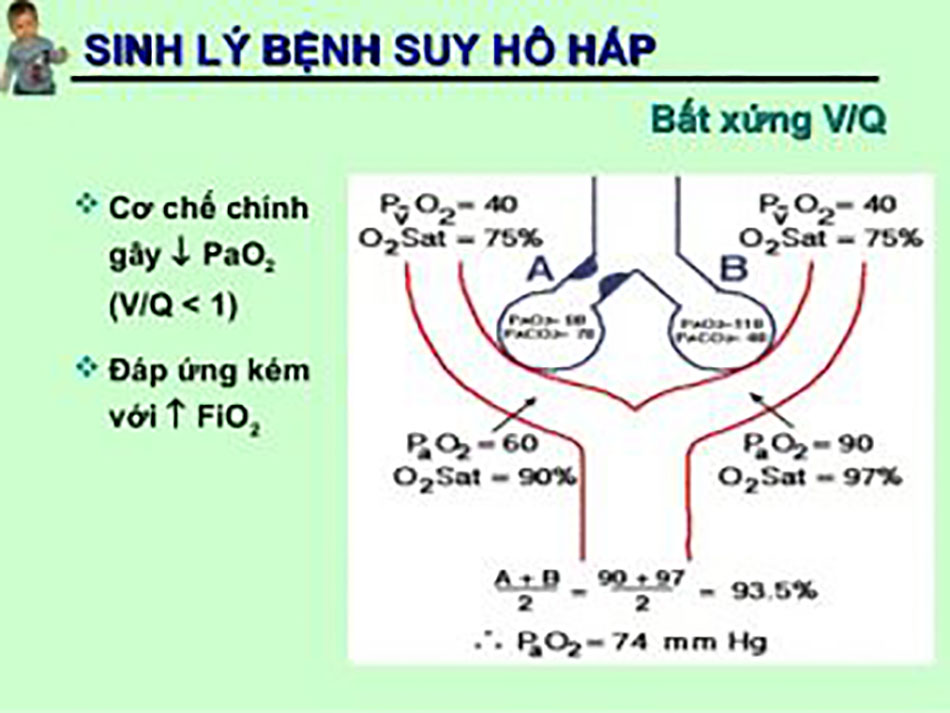 ĐÔNG Y CHỮA SUY HÔ HẤP