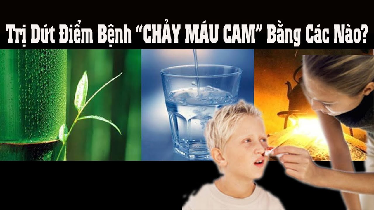 Đông y chữa dứt điểm bệnh chảy máu cam – mẫu