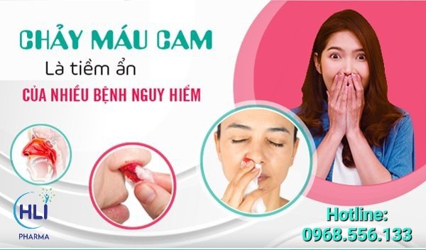 CHẢY MÁU CAM THƯỜNG XUYÊN NÊN LÀM GÌ?