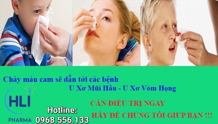 CHẢY MÁU CAM THƯỜNG XUYÊN CẢNH BÁO BỆNH GÌ?