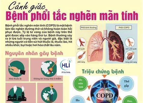 XÂY DỰNG CHƯƠNG TRÌNH PHỤC HỒI CHỨC NĂNG HÔ HẤP CHO NGƯỜI COPD